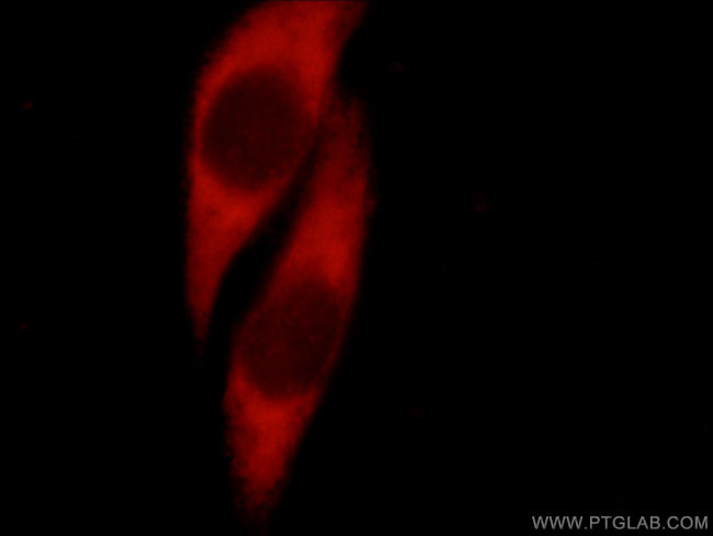 JTV1 Antibody in Immunocytochemistry (ICC/IF)