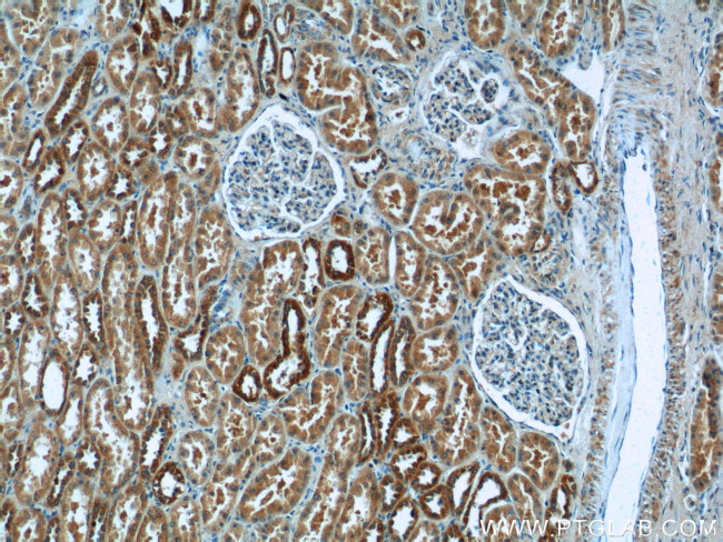 JTV1 Antibody in Immunohistochemistry (Paraffin) (IHC (P))