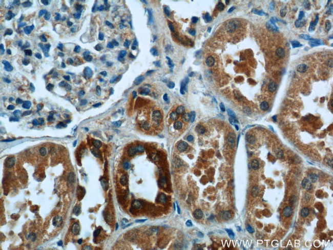 JTV1 Antibody in Immunohistochemistry (Paraffin) (IHC (P))