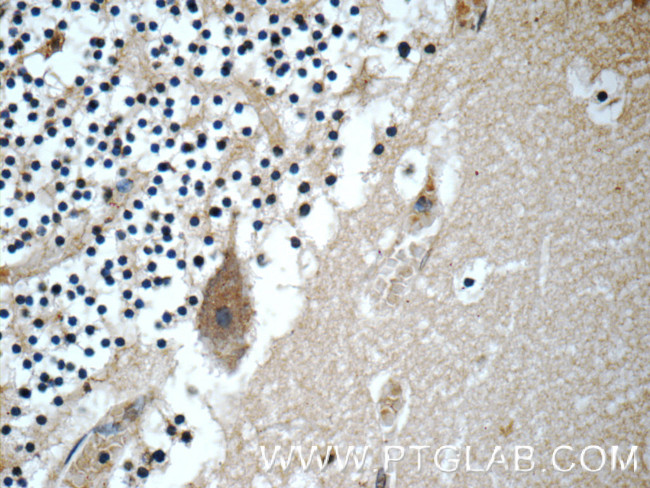 JTV1 Antibody in Immunohistochemistry (Paraffin) (IHC (P))