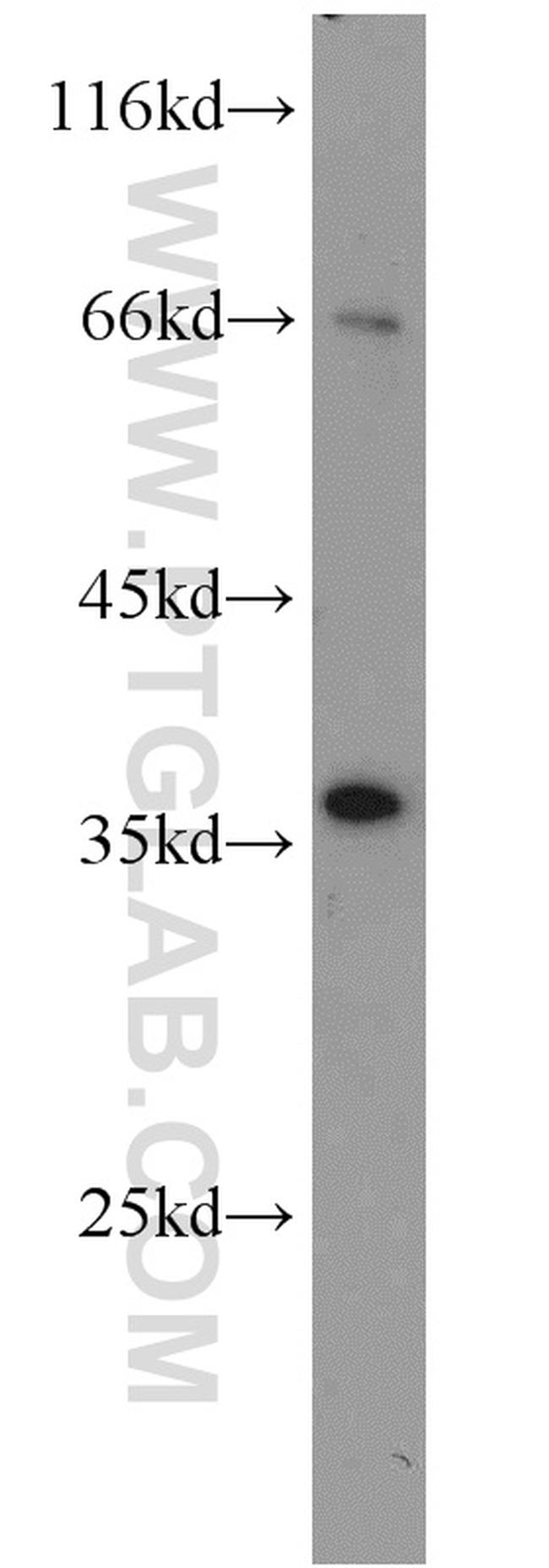 JTV1 Antibody in Western Blot (WB)