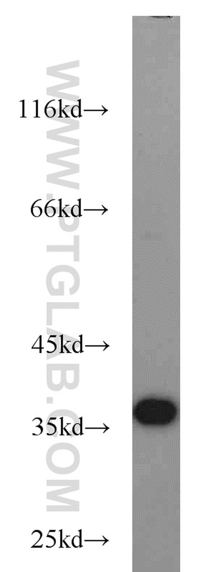 JTV1 Antibody in Western Blot (WB)