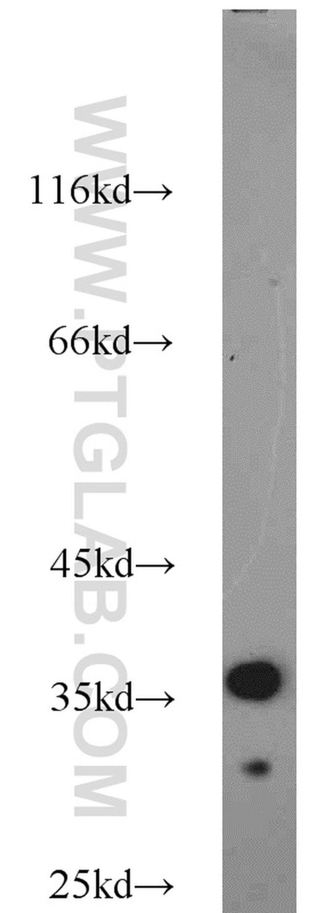 JTV1 Antibody in Western Blot (WB)