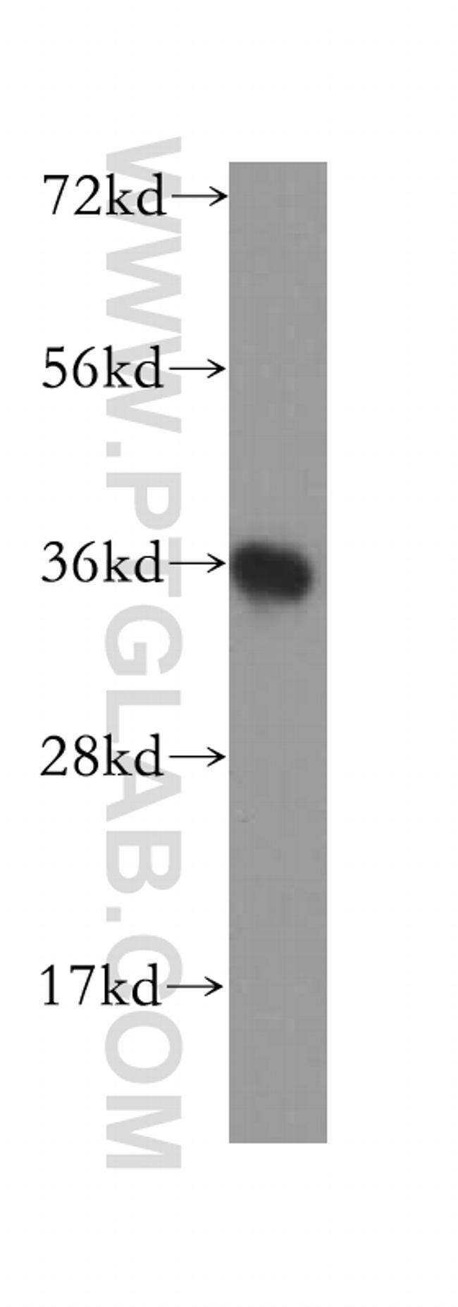 JTV1 Antibody in Western Blot (WB)