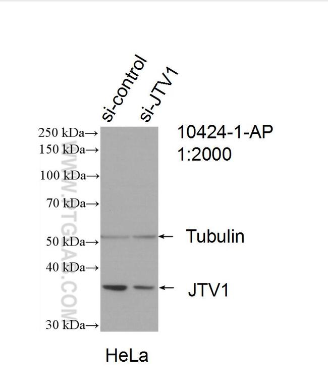 JTV1 Antibody in Western Blot (WB)