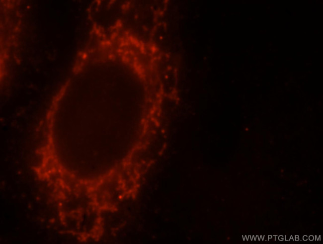 YY1AP1 Antibody in Immunocytochemistry (ICC/IF)