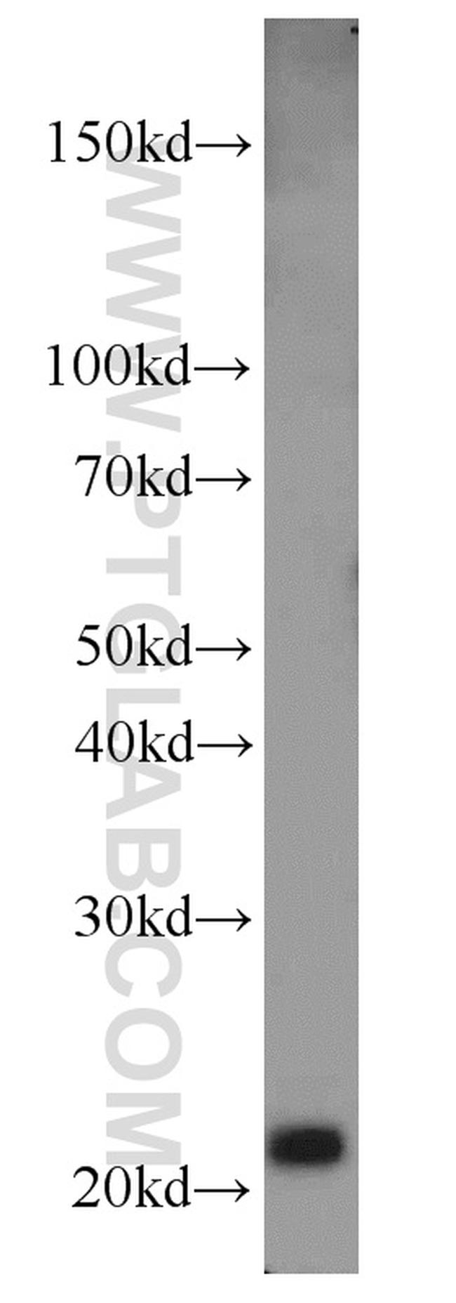 MAX Antibody in Western Blot (WB)