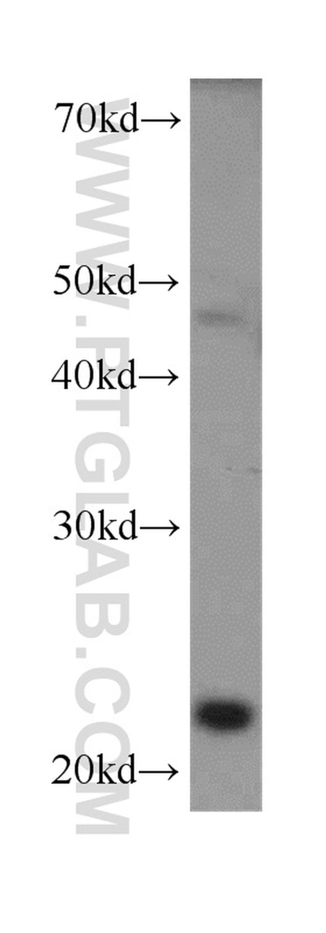 MAX Antibody in Western Blot (WB)