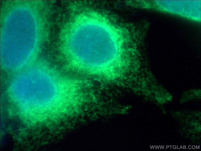 Calnexin Antibody in Immunocytochemistry (ICC/IF)