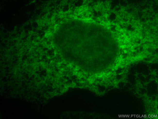 Calnexin Antibody in Immunocytochemistry (ICC/IF)