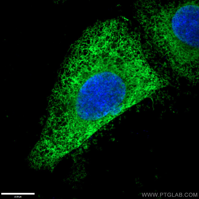 Calnexin Antibody in Immunocytochemistry (ICC/IF)