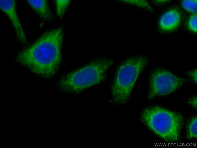 Calnexin Antibody in Immunocytochemistry (ICC/IF)