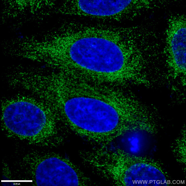 Calnexin Antibody in Immunocytochemistry (ICC/IF)