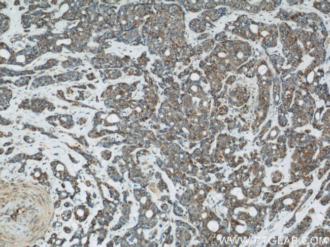 Calnexin Antibody in Immunohistochemistry (Paraffin) (IHC (P))