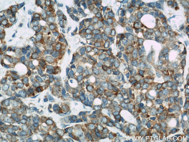 Calnexin Antibody in Immunohistochemistry (Paraffin) (IHC (P))