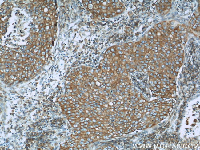 Calnexin Antibody in Immunohistochemistry (Paraffin) (IHC (P))