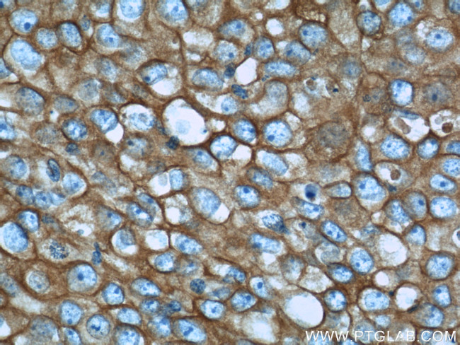 Calnexin Antibody in Immunohistochemistry (Paraffin) (IHC (P))