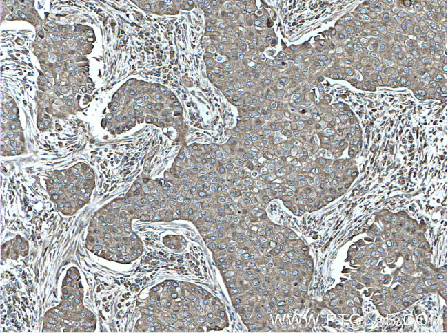 Calnexin Antibody in Immunohistochemistry (Paraffin) (IHC (P))