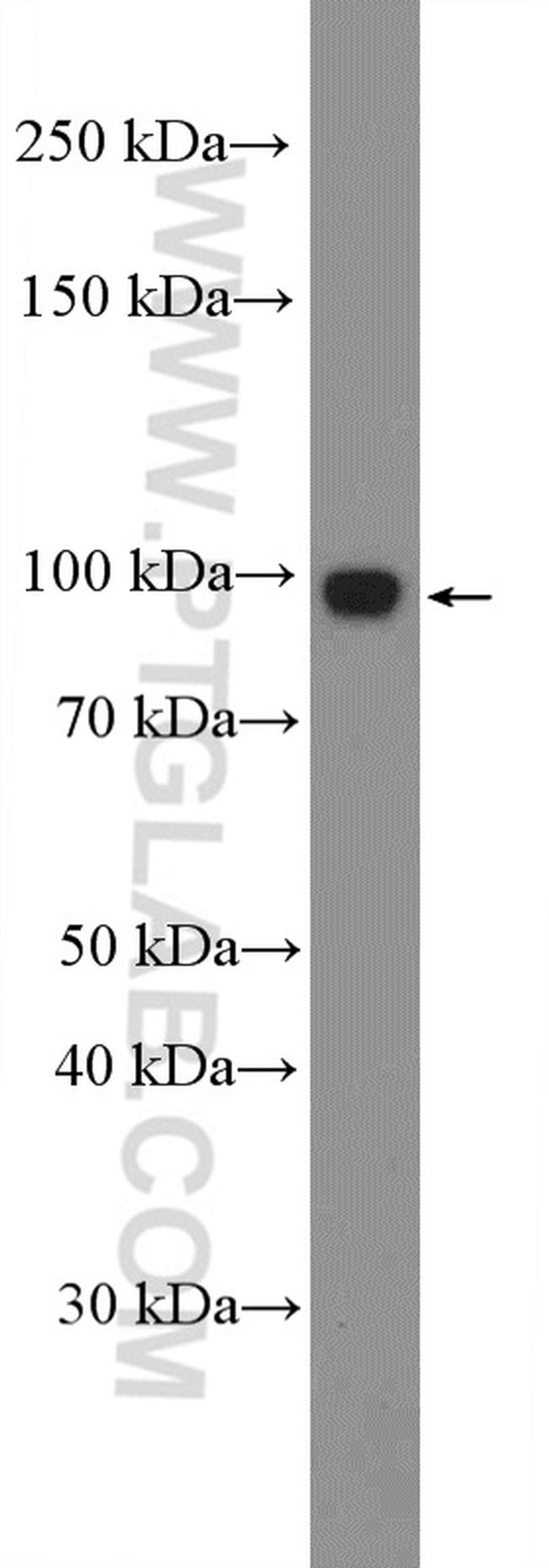 Calnexin Antibody in Western Blot (WB)