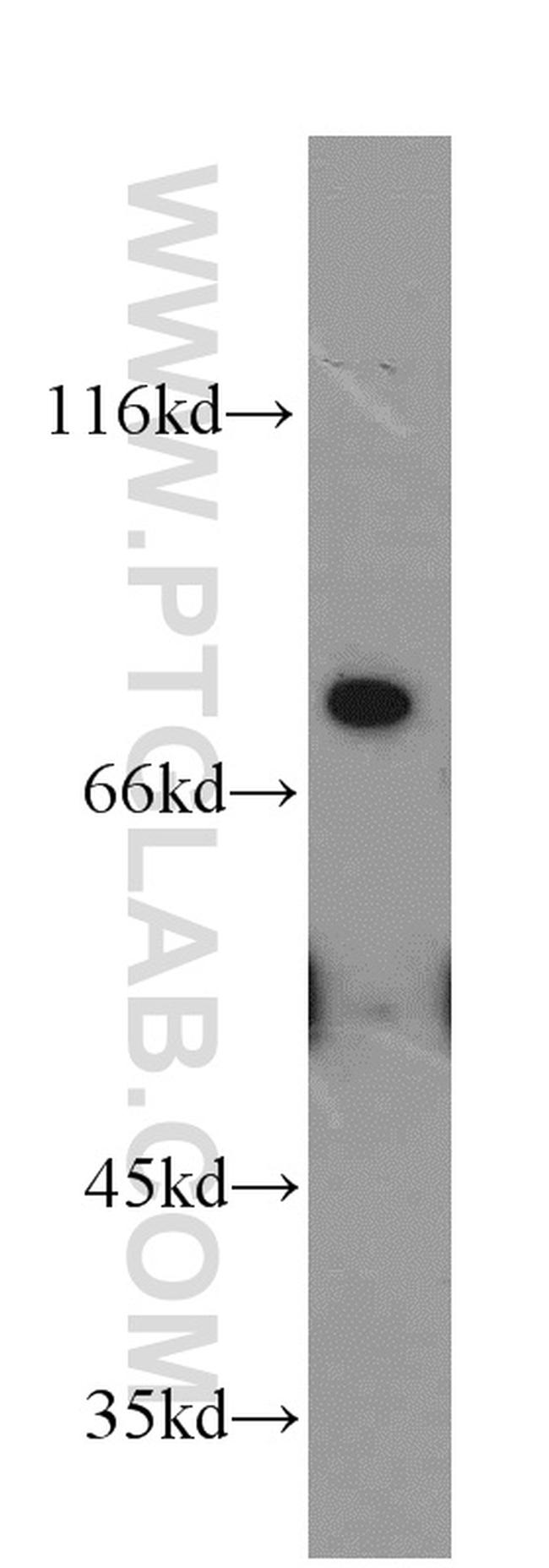 MFI2 Antibody in Western Blot (WB)