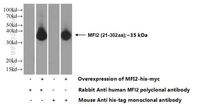 MFI2 Antibody in Western Blot (WB)