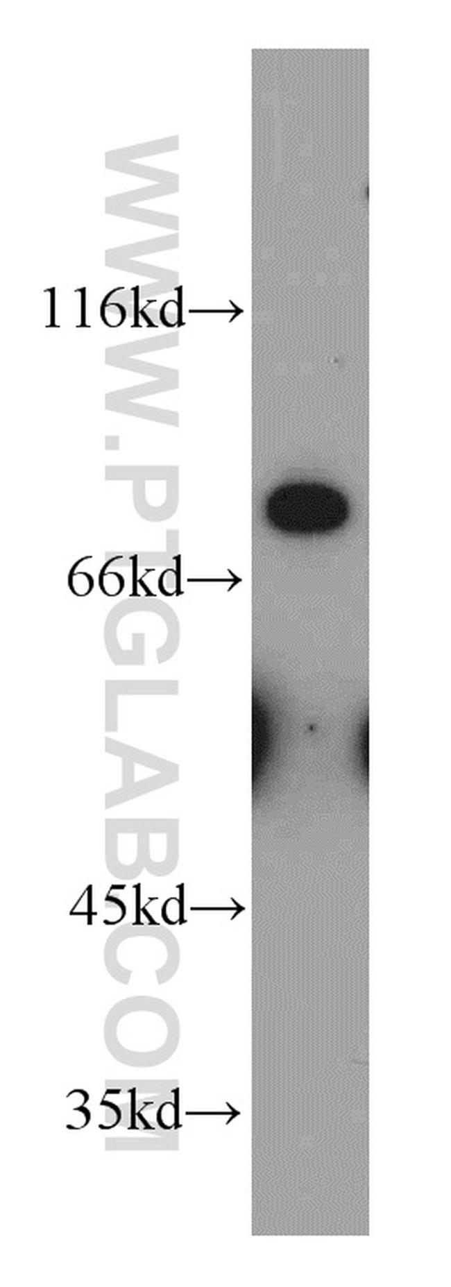 MFI2 Antibody in Western Blot (WB)