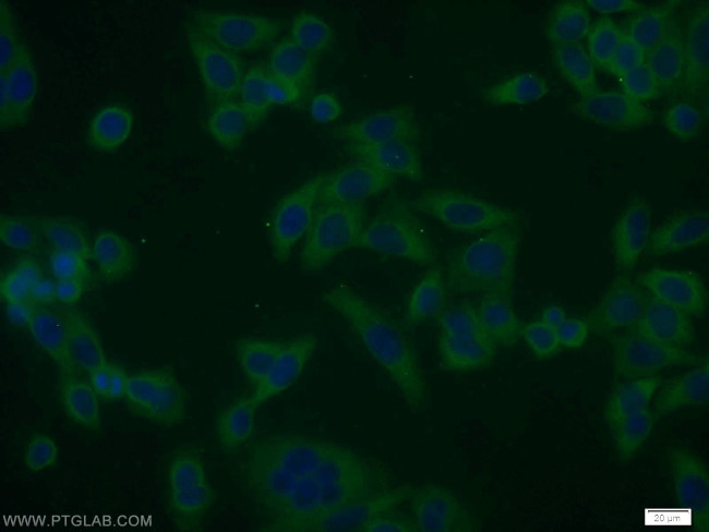 SMAD1 Antibody in Immunocytochemistry (ICC/IF)