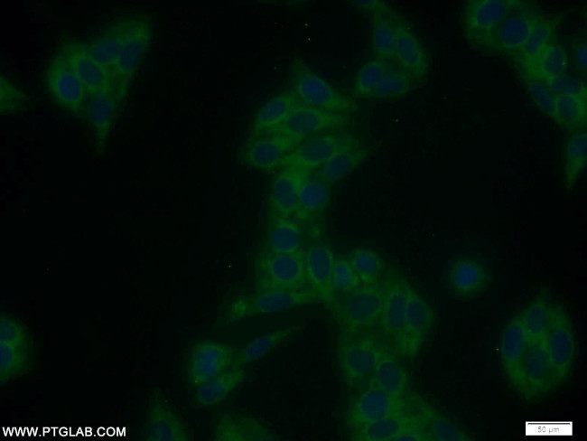 SMAD1 Antibody in Immunocytochemistry (ICC/IF)