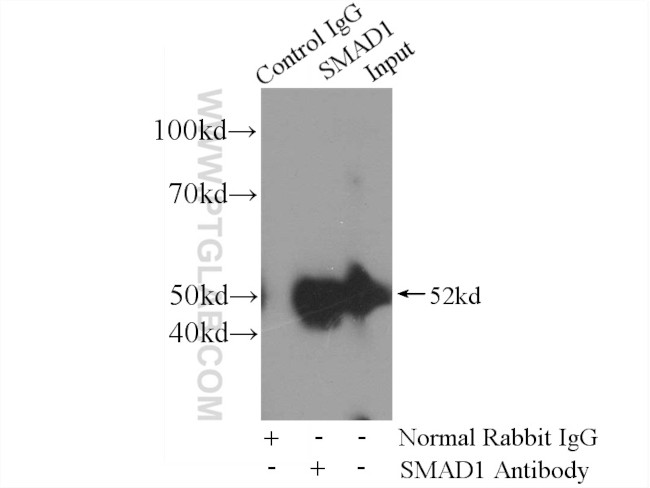 SMAD1 Antibody in Immunoprecipitation (IP)