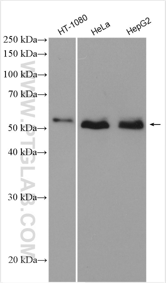 SMAD1 Antibody in Western Blot (WB)