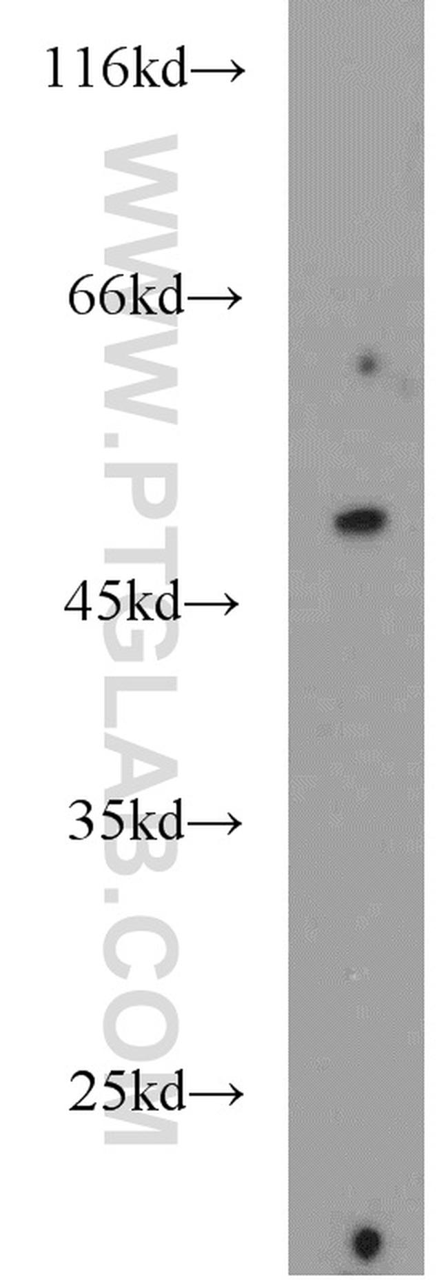 SMAD1 Antibody in Western Blot (WB)