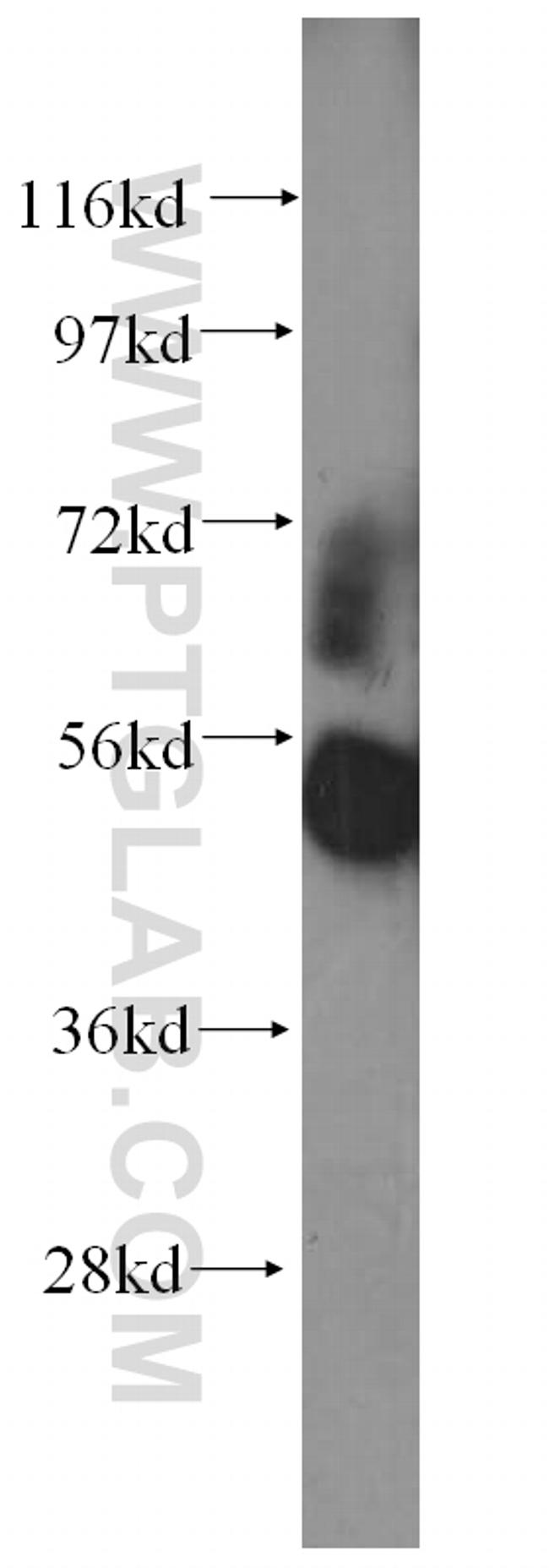 SMAD1 Antibody in Western Blot (WB)