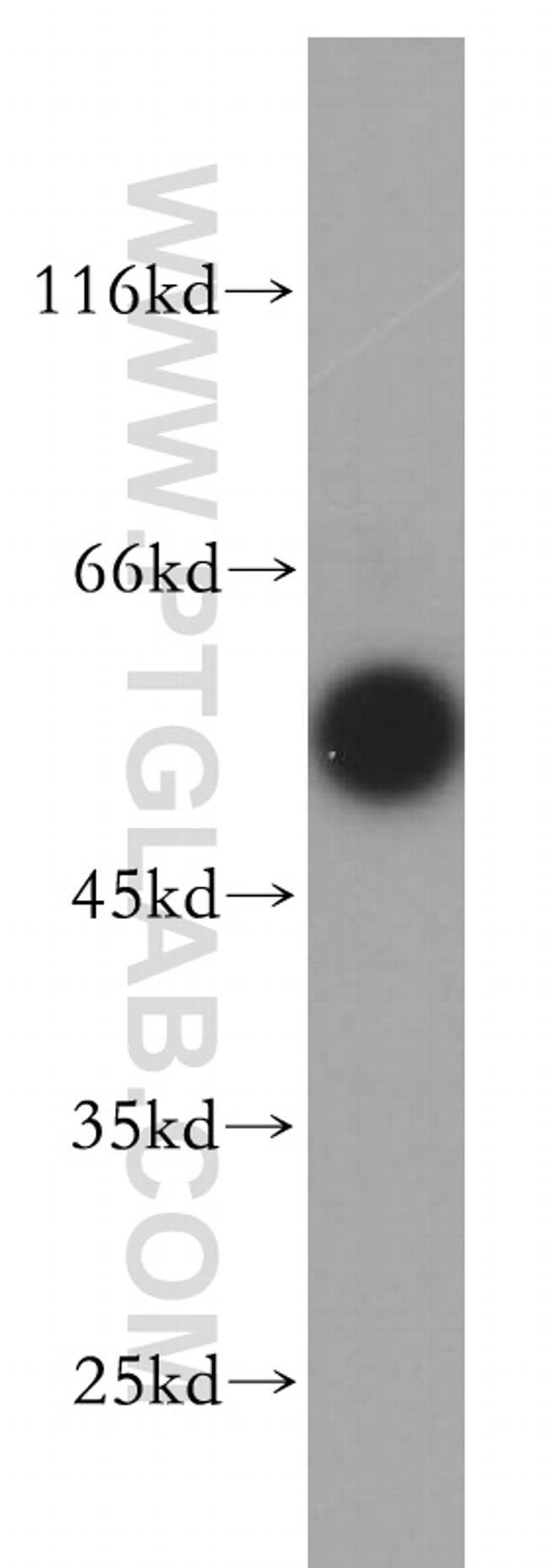 SMAD1 Antibody in Western Blot (WB)