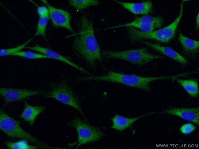 CDK5 Antibody in Immunocytochemistry (ICC/IF)