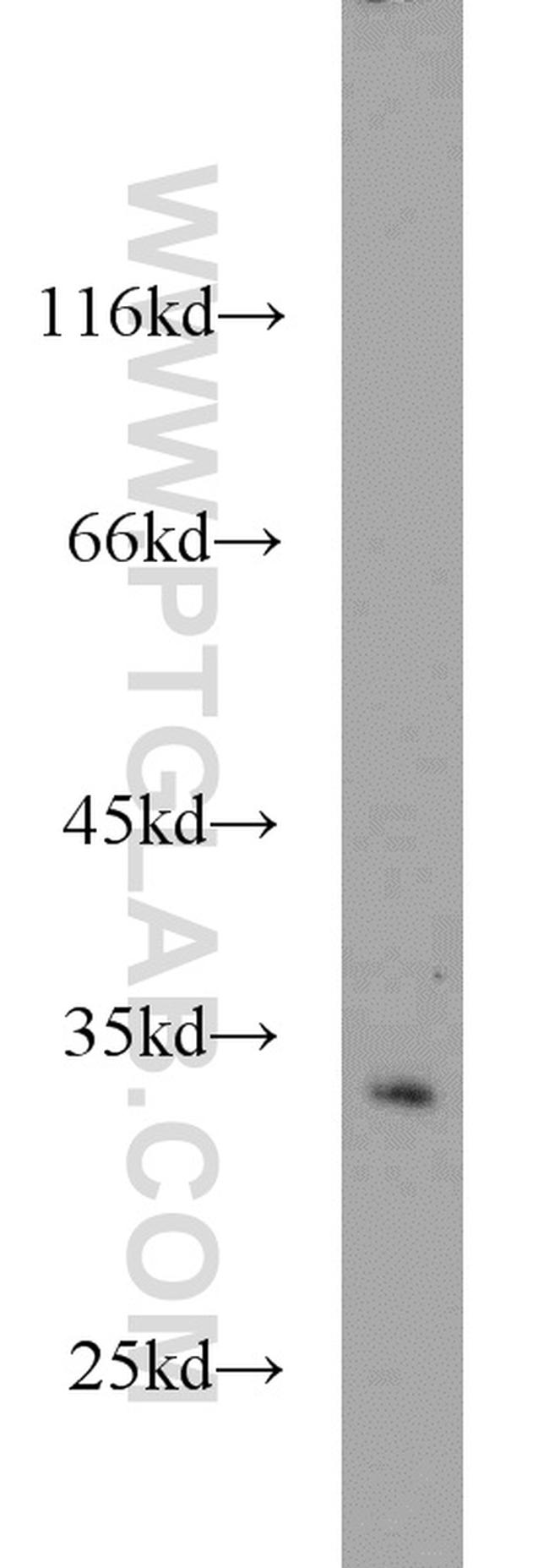 CDK5 Antibody in Western Blot (WB)