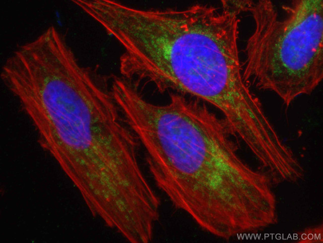 DIABLO Antibody in Immunocytochemistry (ICC/IF)