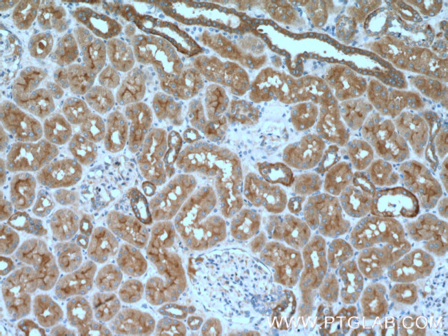 Caspase 2/p18 Antibody in Immunohistochemistry (Paraffin) (IHC (P))