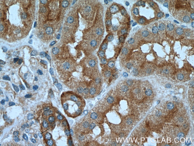 Caspase 2/p18 Antibody in Immunohistochemistry (Paraffin) (IHC (P))