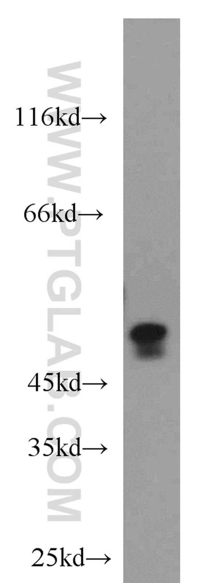 Caspase 2/p18 Antibody in Western Blot (WB)