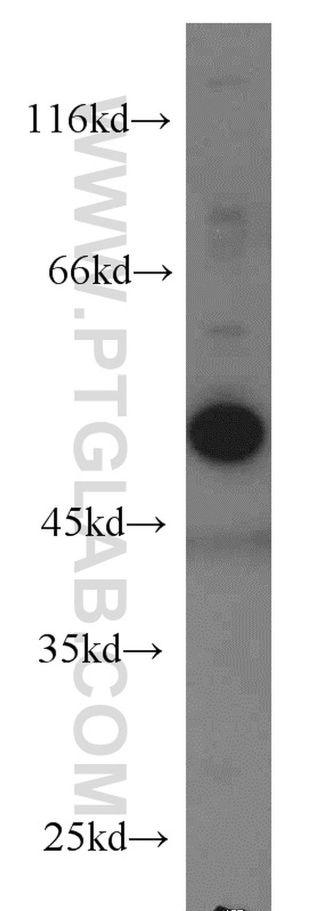 Caspase 2/p18 Antibody in Western Blot (WB)
