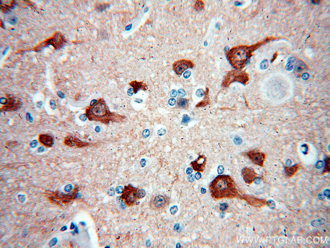 Neurogranin Antibody in Immunohistochemistry (Paraffin) (IHC (P))