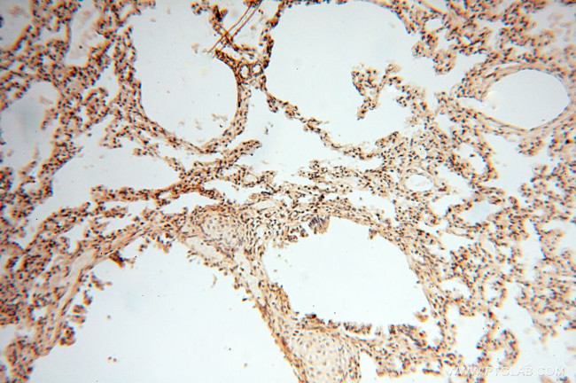 Neurogranin Antibody in Immunohistochemistry (Paraffin) (IHC (P))