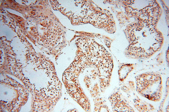 Neurogranin Antibody in Immunohistochemistry (Paraffin) (IHC (P))