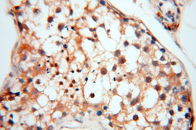 Neurogranin Antibody in Immunohistochemistry (Paraffin) (IHC (P))