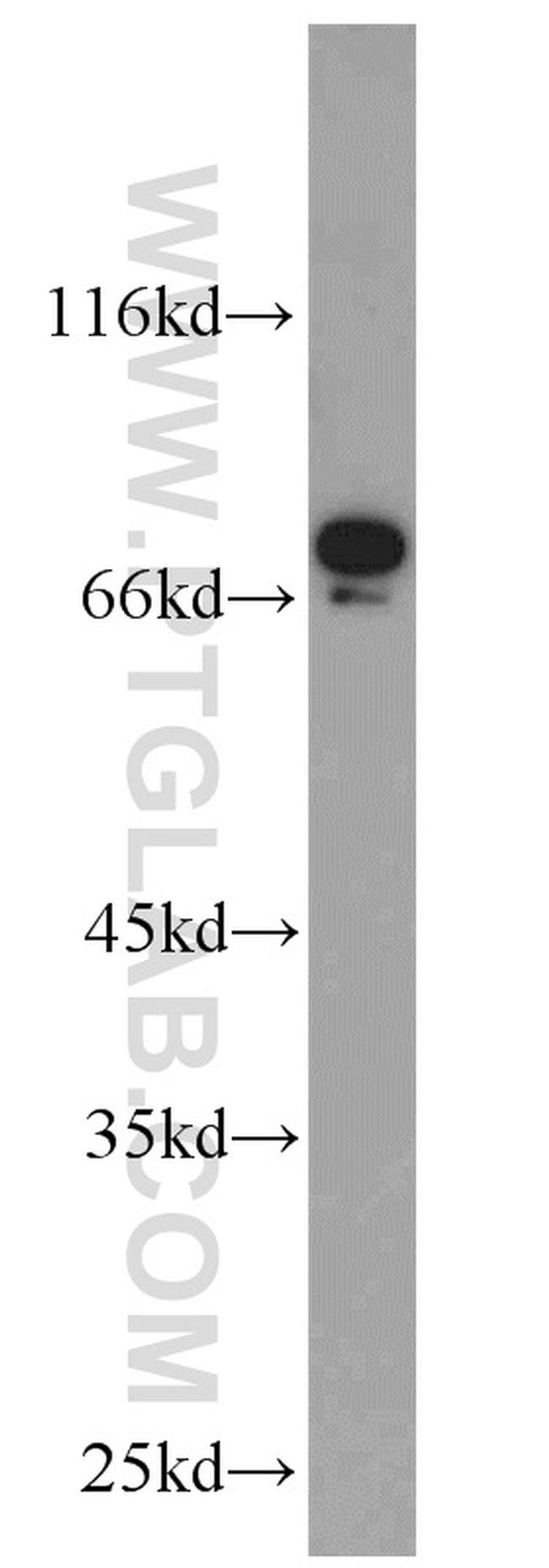 TORC1 Antibody in Western Blot (WB)