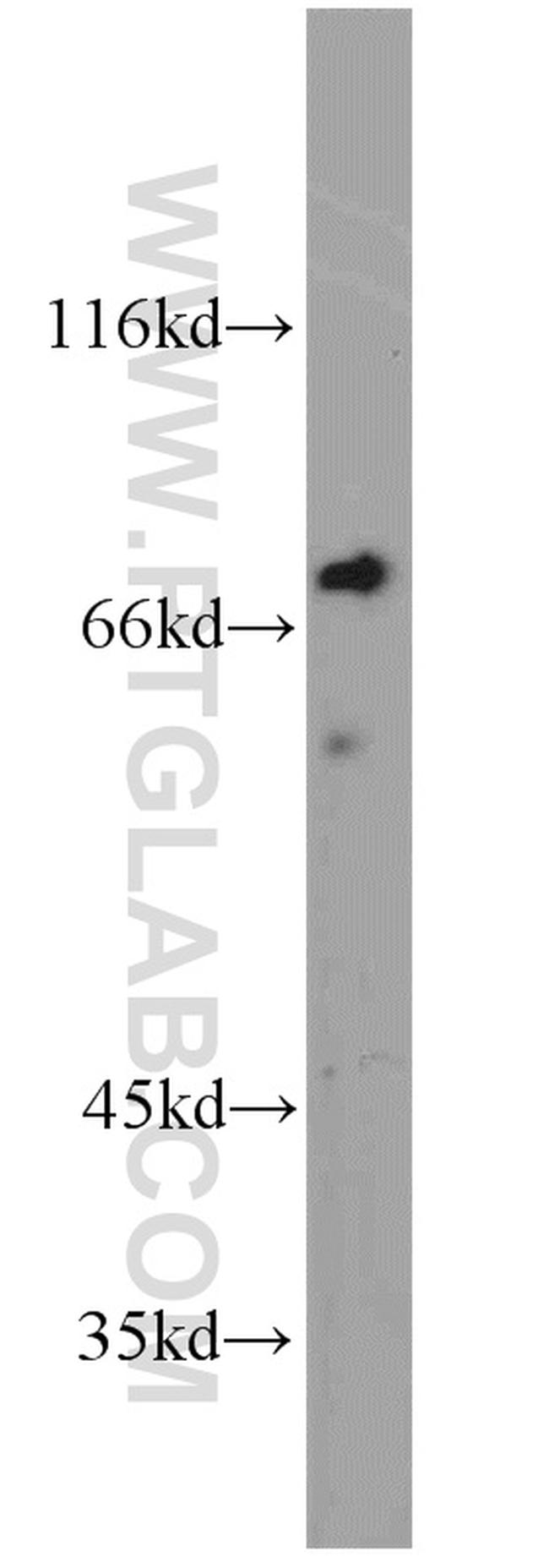 TORC1 Antibody in Western Blot (WB)