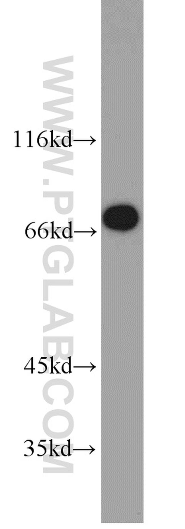 TORC1 Antibody in Western Blot (WB)