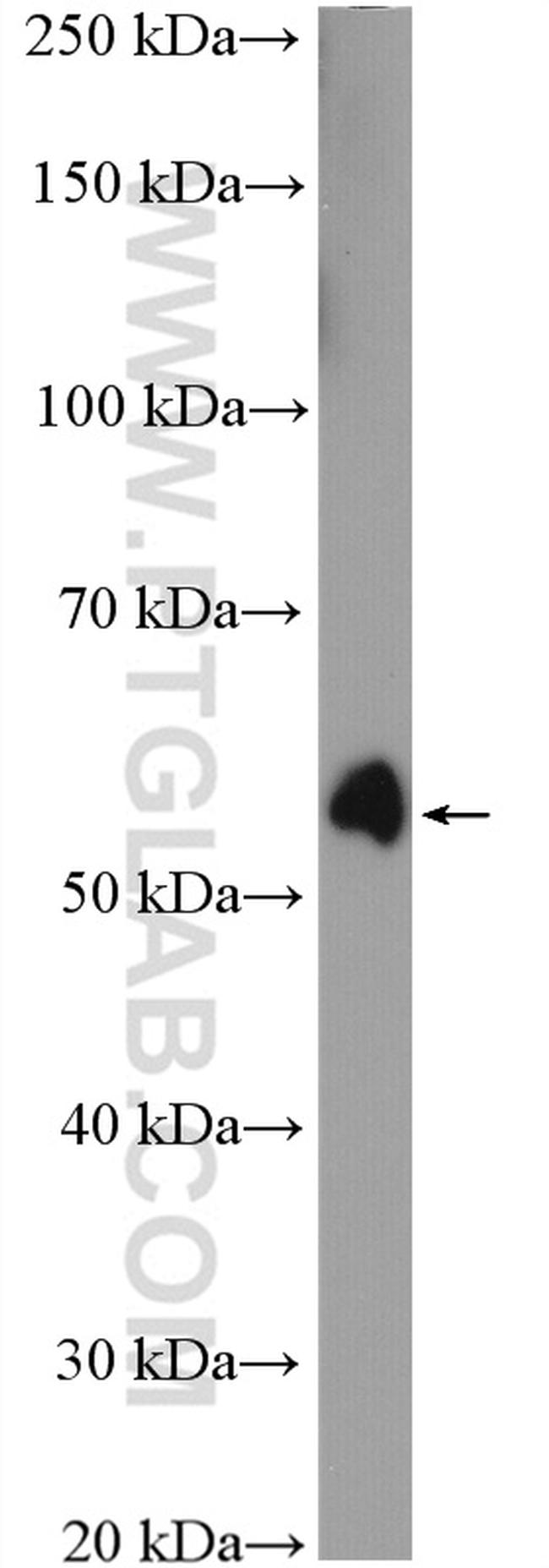 P53 Antibody in Western Blot (WB)