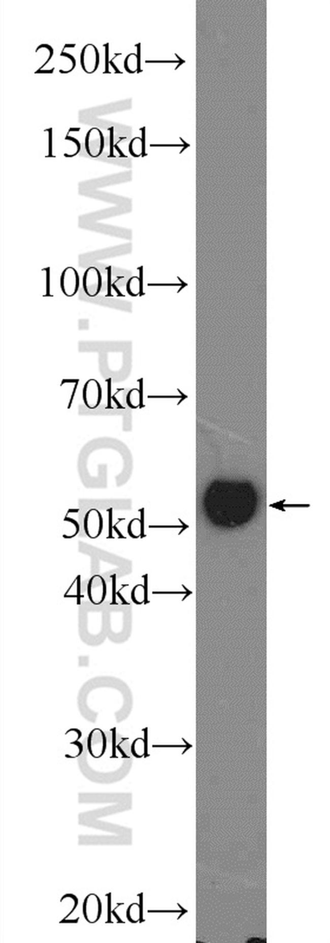 P53 Antibody in Western Blot (WB)