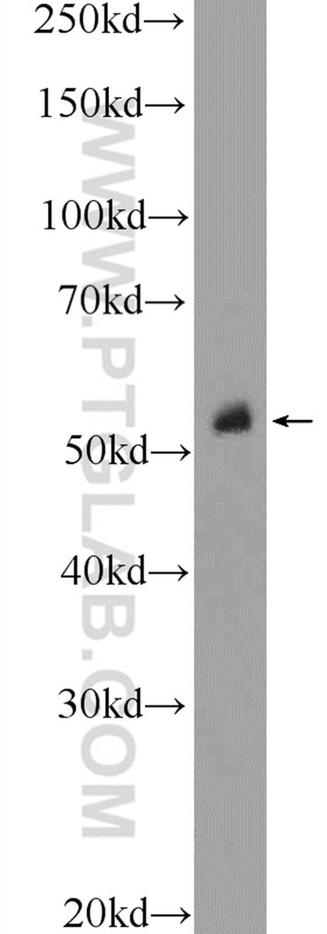 P53 Antibody in Western Blot (WB)